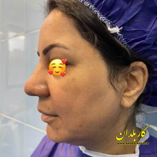 دکتر زنگنه دکتر خوب زیبایی تهران گالری 66