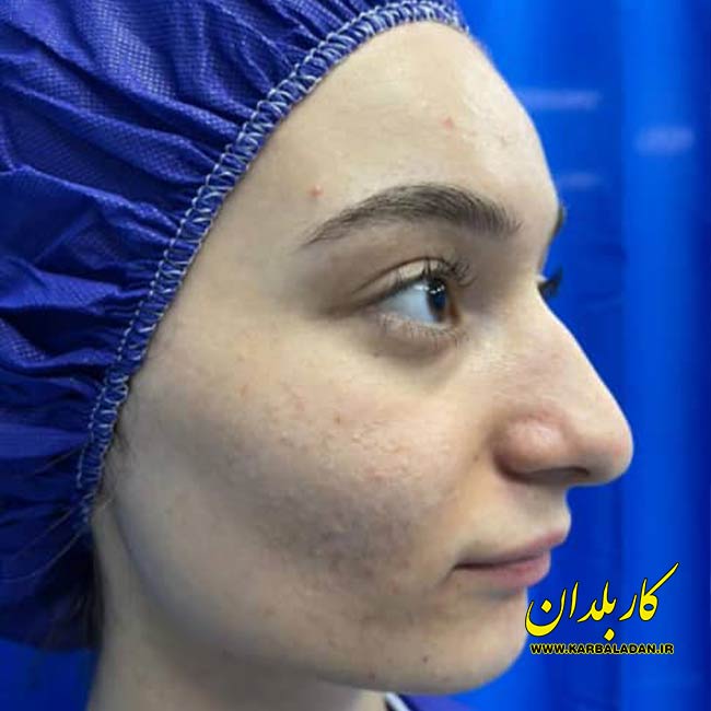 دکتر زنگنه دکتر خوب زیبایی تهران گالری 77