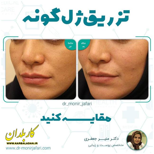 دکتر منیر جعفری دکتر خوب زیبایی تهران گالری 1