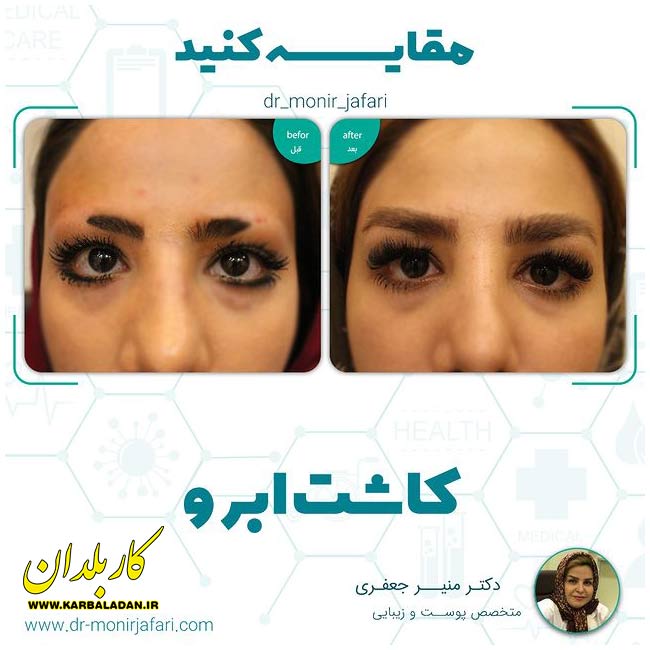 دکتر منیر جعفری دکتر خوب زیبایی تهران گالری 3